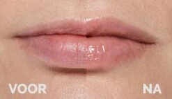 Instant Effects - 3D Lip Plumper Lipgloss Lip Filler - 20% Vollere Lippen In Slechts 2 Minuten! -Cosmetisch Korting 1200x696