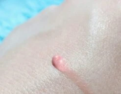 Biodermal Sun Lipbalm SPF25 - Tube 12 Ml - Natural Pink - Lippenbalsem -Cosmetisch Korting 1200x927